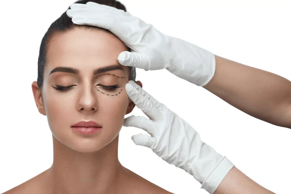 Imagen de  blefaroplastia